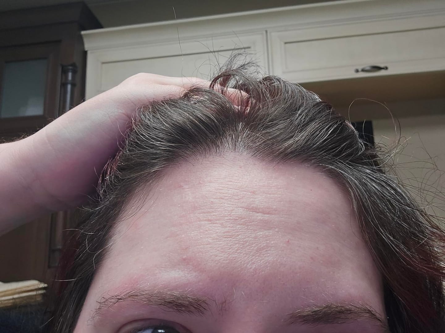 Customer photo review of RootRevive Scalp Serum