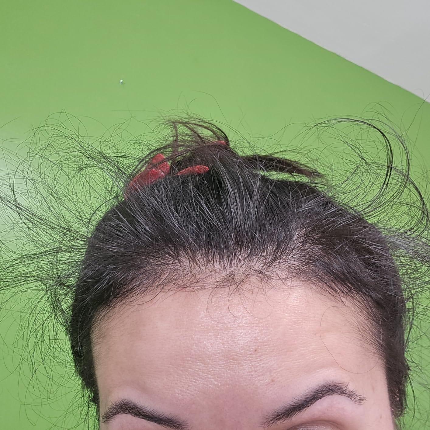 Customer photo review of RootRevive Scalp Serum
