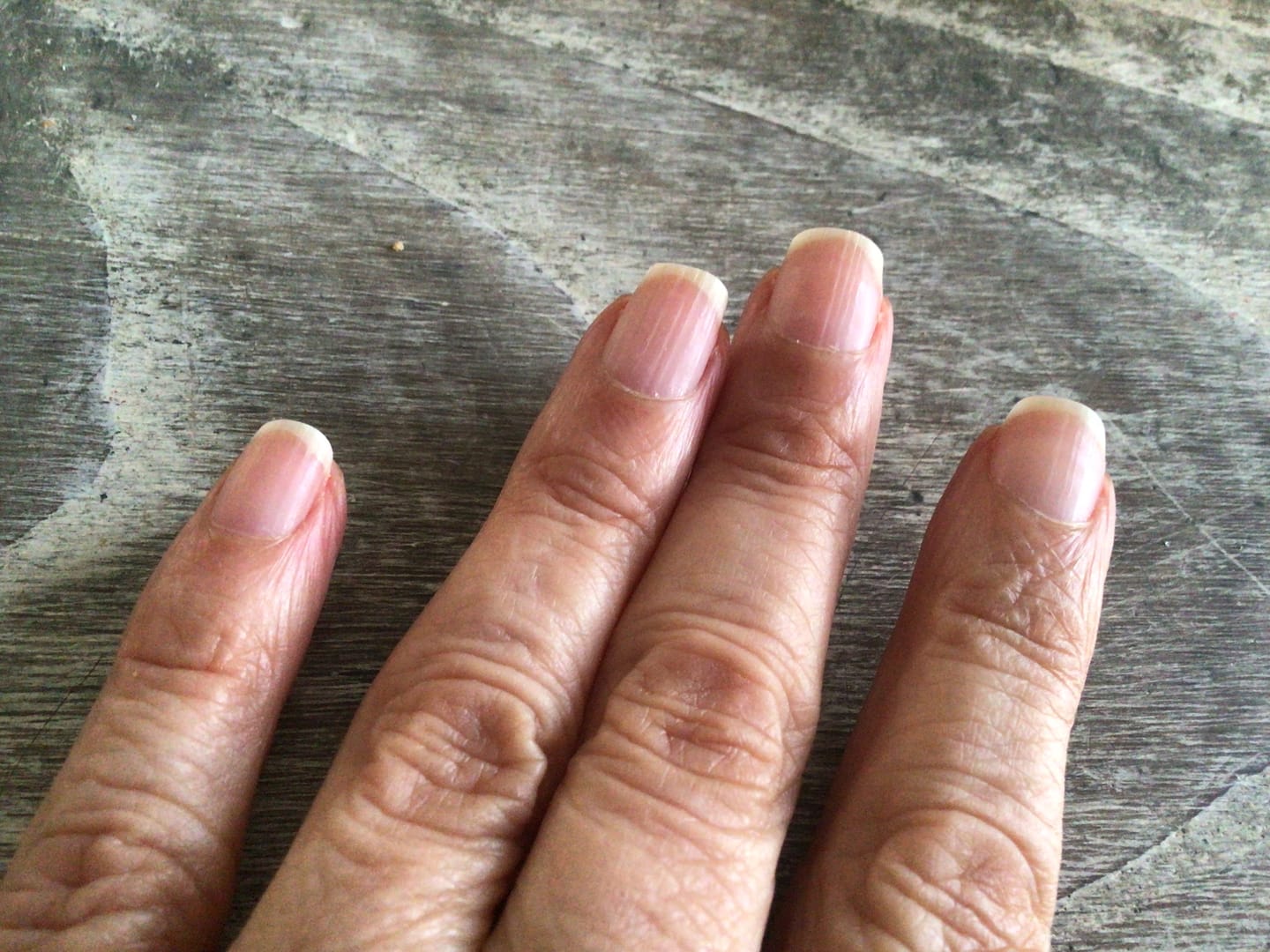 Customer photo review of Optimal Collagen Plus