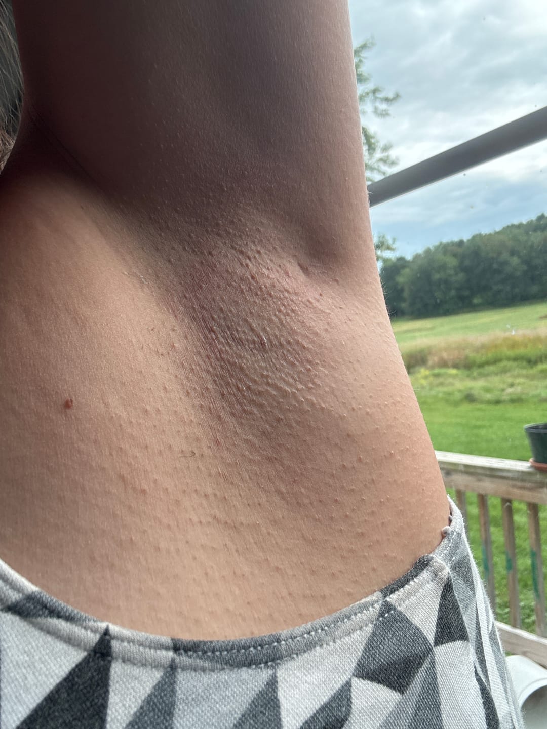 Customer photo review of Jelly Wax® All-In-One Wax Bundle