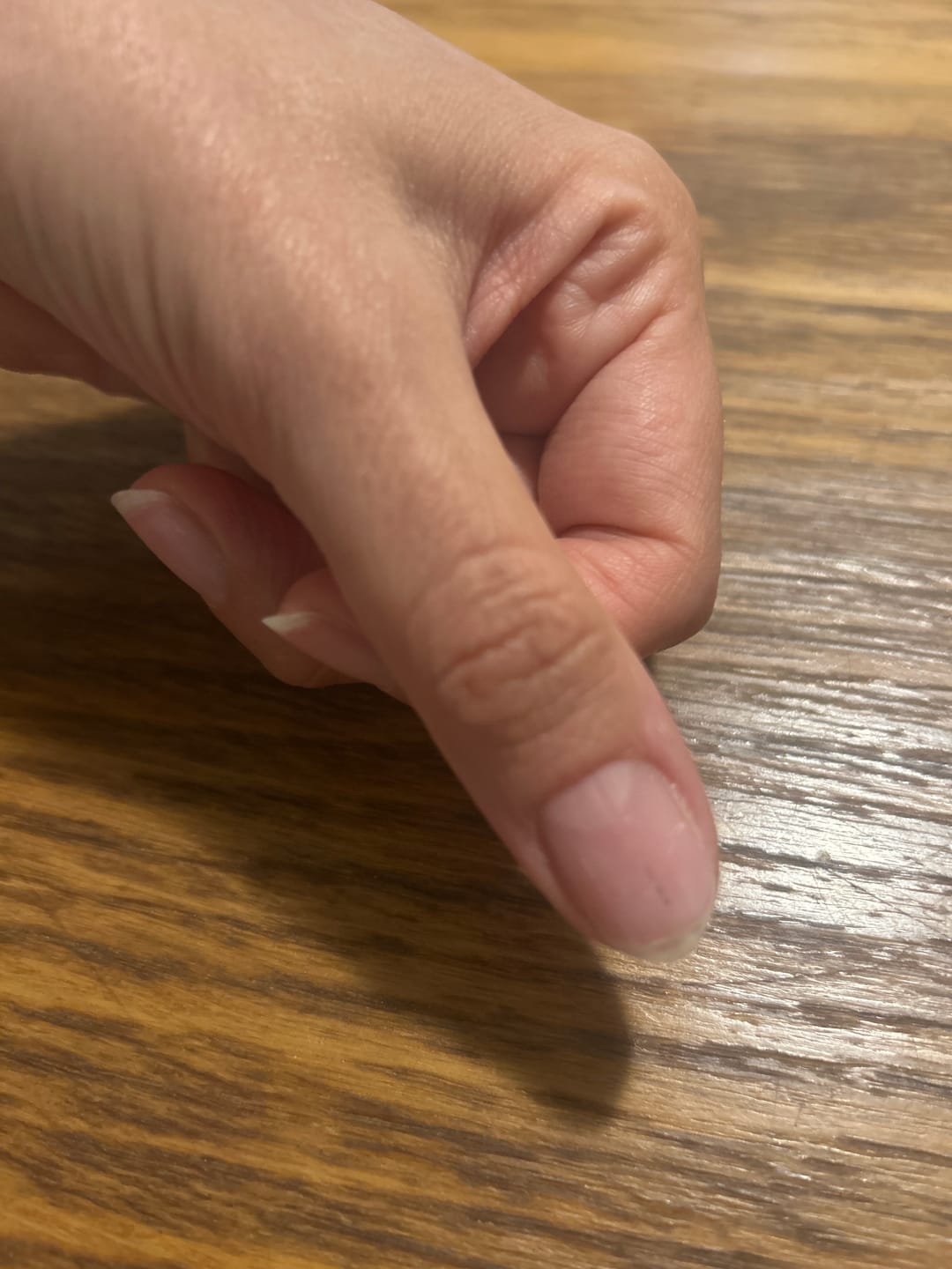 Customer photo review of AHA Cuticle Remover 30 ml LCI