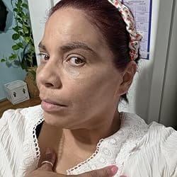 Customer photo review of ToneFix™ Full Coverage Foundation