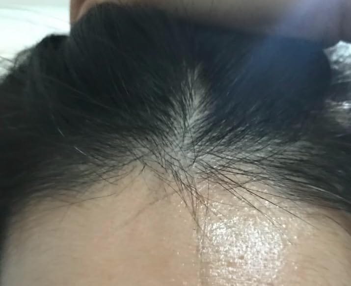 Customer photo review of RootRevive Scalp Serum