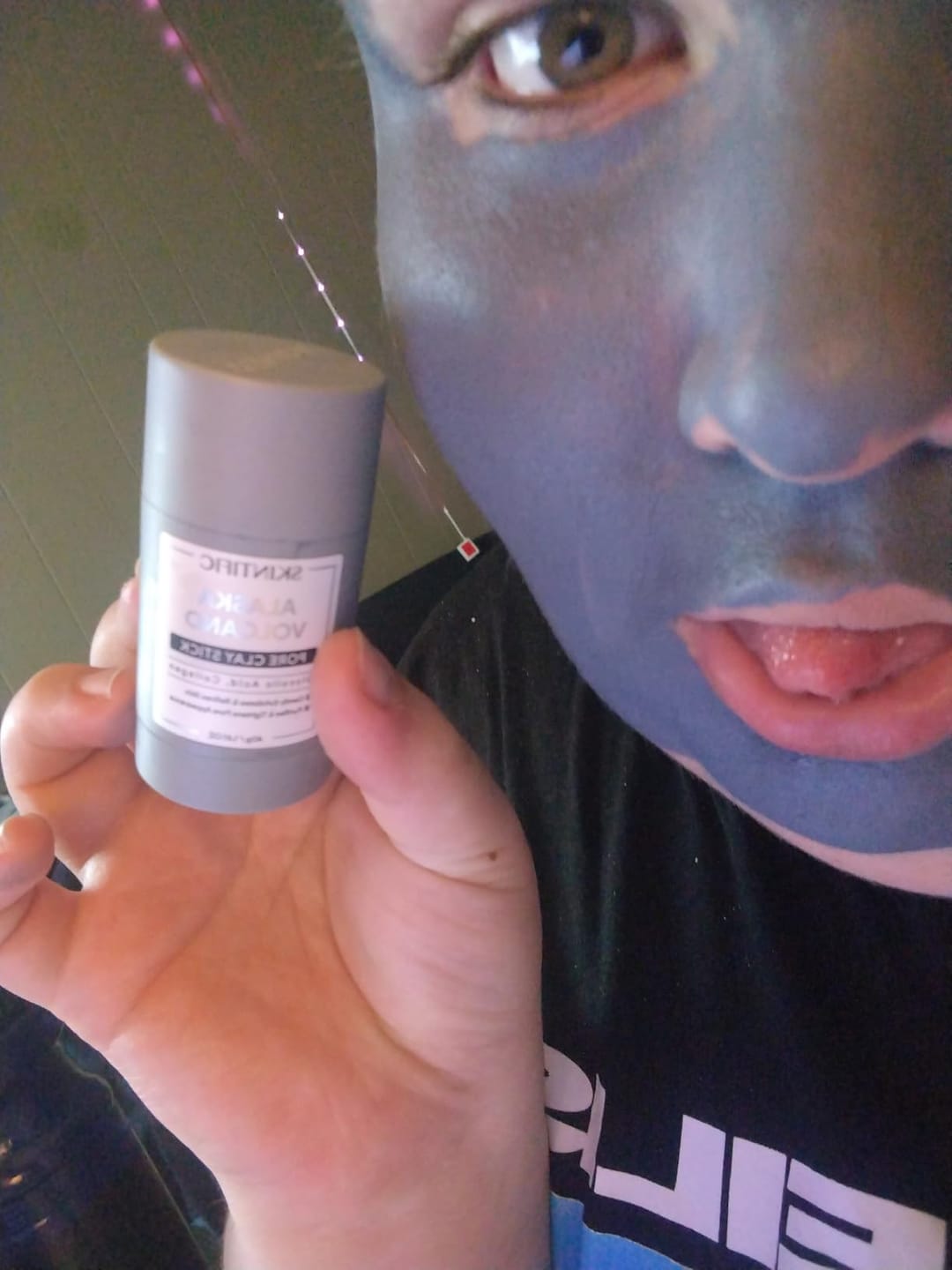 Customer photo review of Reduce tus brotes y puntos negros en solo 14 días