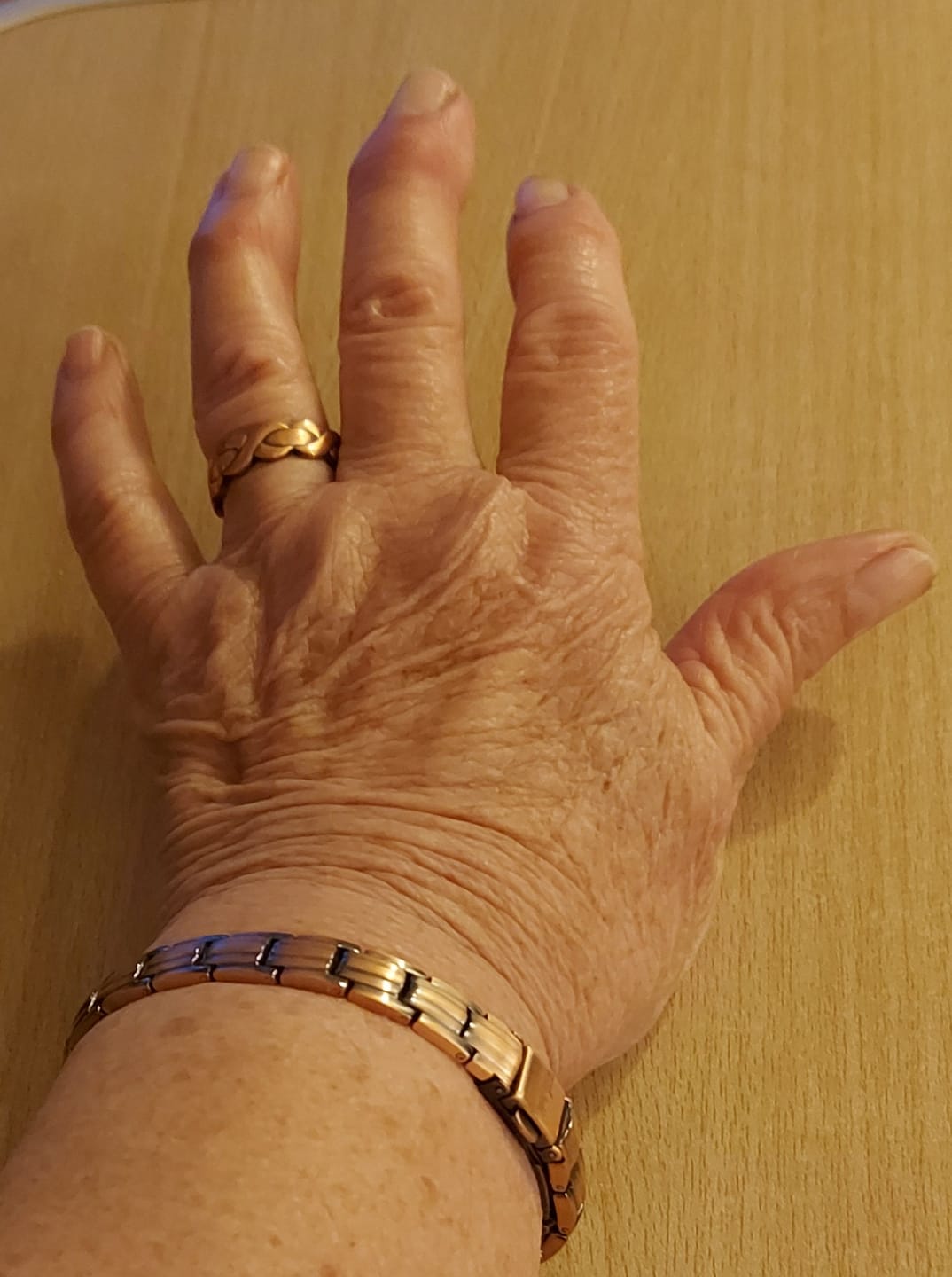 Customer photo review of Ladies Adjustable Copper Magnetic Ring