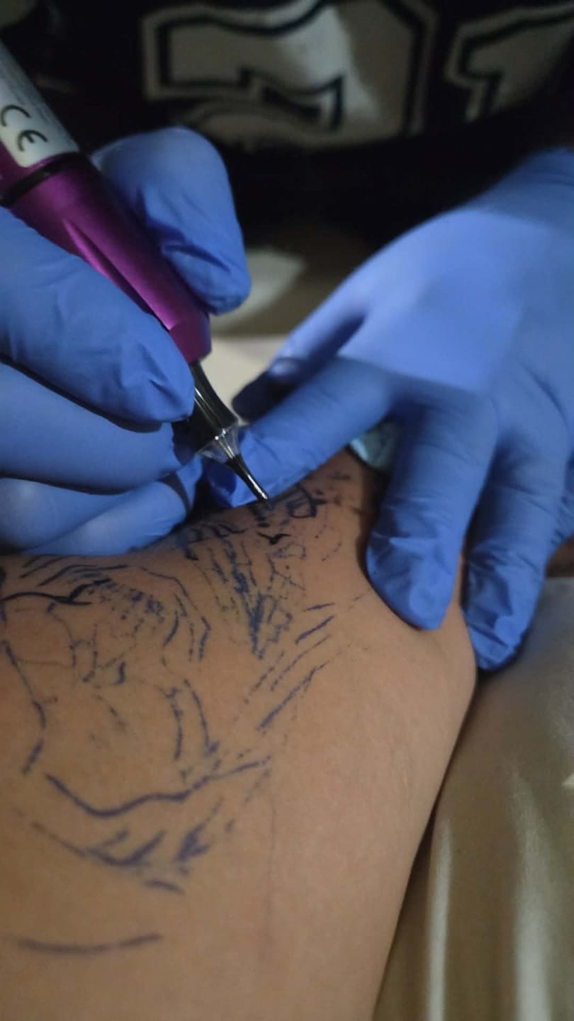 Customer photo review of Neebol Tattoo Needles Cartridges - 0.3/0.35MM Round Liner | IRIS