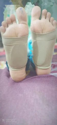 Customer photo review of Gel Arch Support Band – Cushioned Foot Support for Heels, Walking & Long Standing