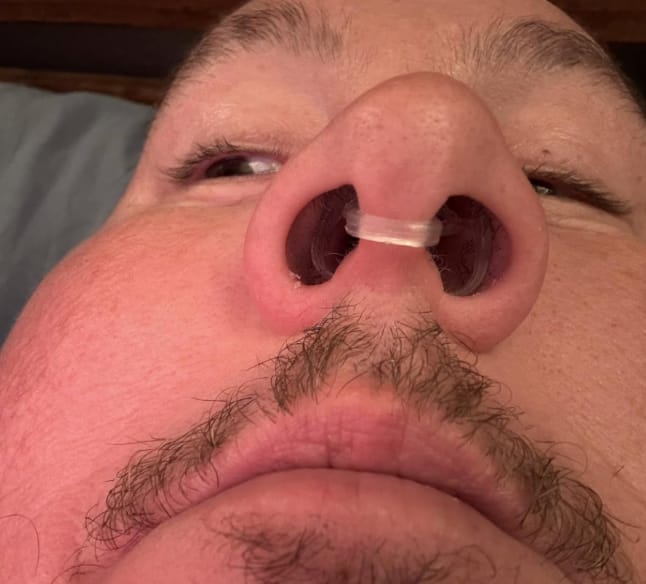 Customer photo review of FLO Nasal Dilator (3 Pack)