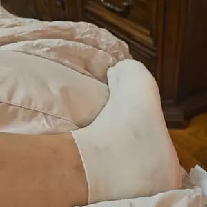 Customer photo review of Idratazione Profonda Calze in Silicone per Piedi Screpolati