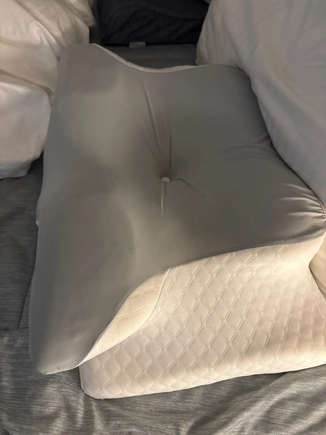 Customer photo review of ORVANE Butterfly™ – 5 Zone Neck & Shoulder Pain Relief Pillow