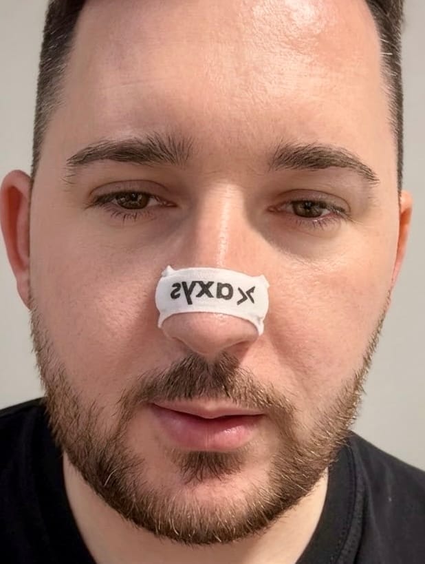 Customer photo review of Axys Trake za Nos