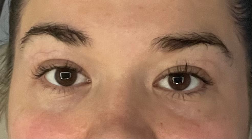 Customer photo review of Lash Growth Serum