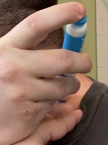 Customer photo review of Removedor Indoloro de Fibromas