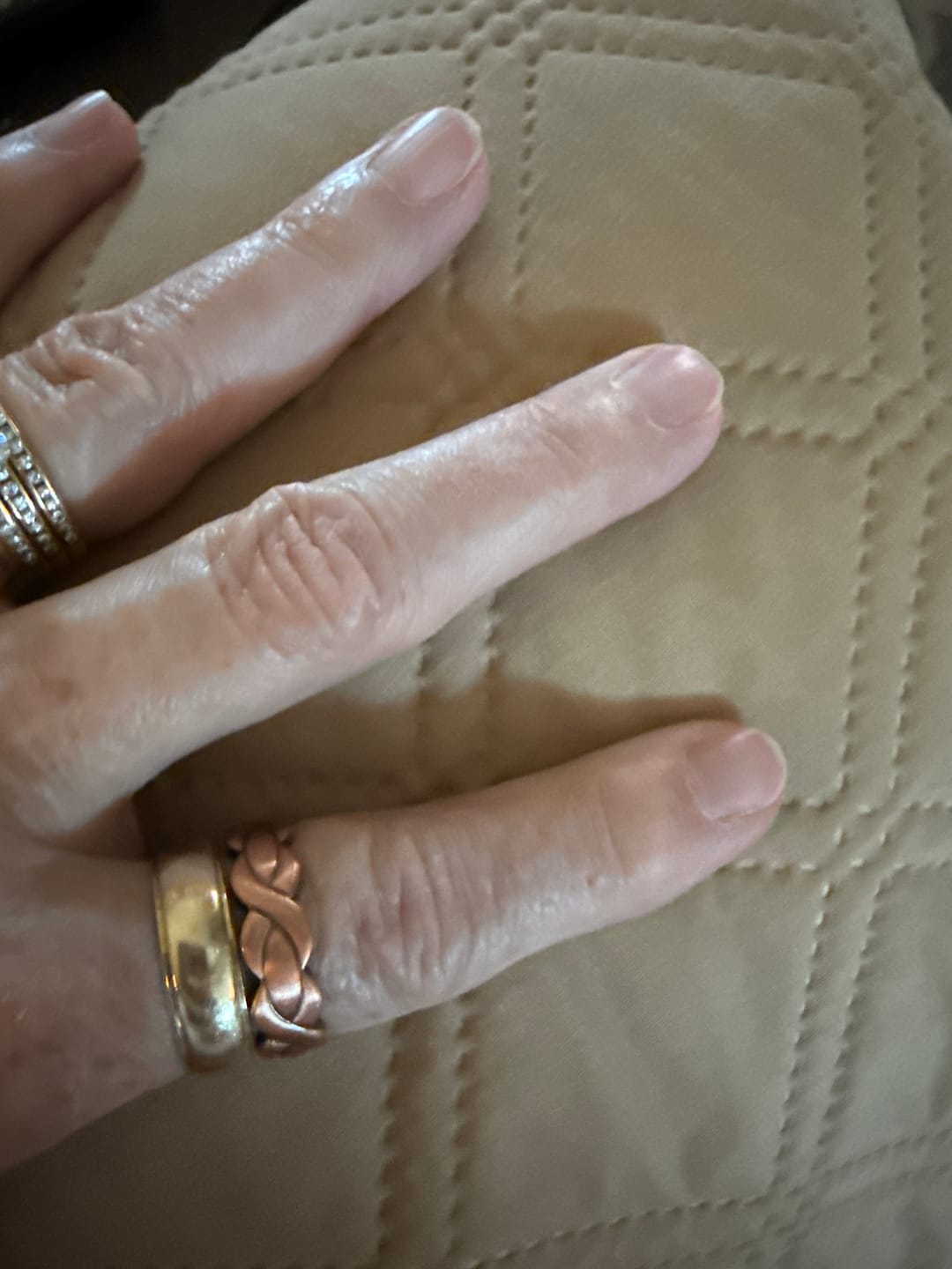 Customer photo review of Ladies Adjustable Copper Magnetic Ring