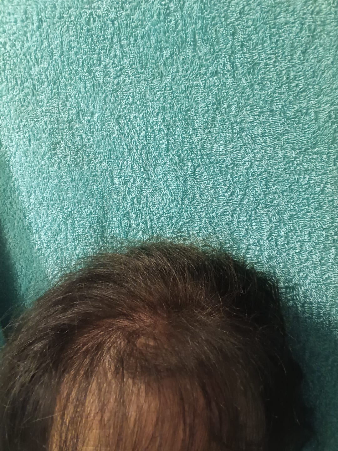 Customer photo review of Ansatzpuder von IMPERIO® | Wasserfeste Qualität