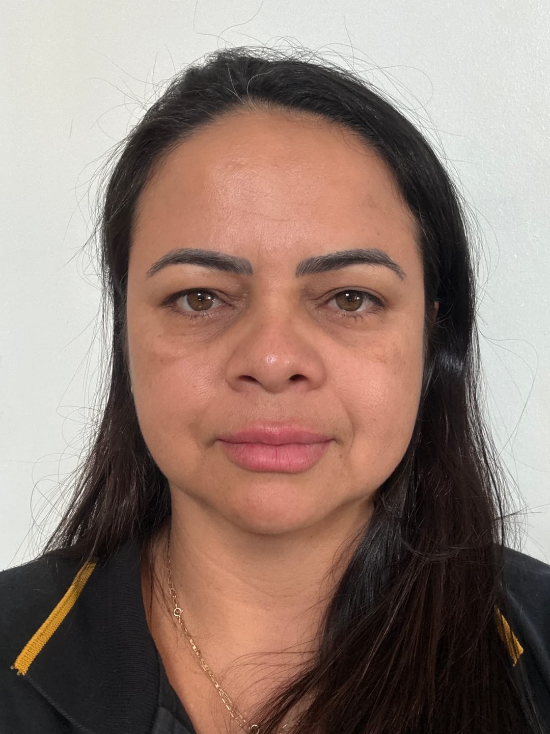 Customer photo review of Creme Clareador de Manchas – Melasma, Axilas, Virilha, Áreas Íntimas, Rosto e Corpo