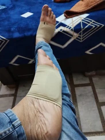 Customer photo review of Gel Arch Support Band – Cushioned Foot Support for Heels, Walking & Long Standing