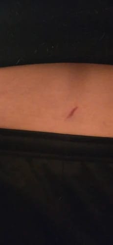 Customer photo review of STIMMAX Red Light Therapy Massage Belt