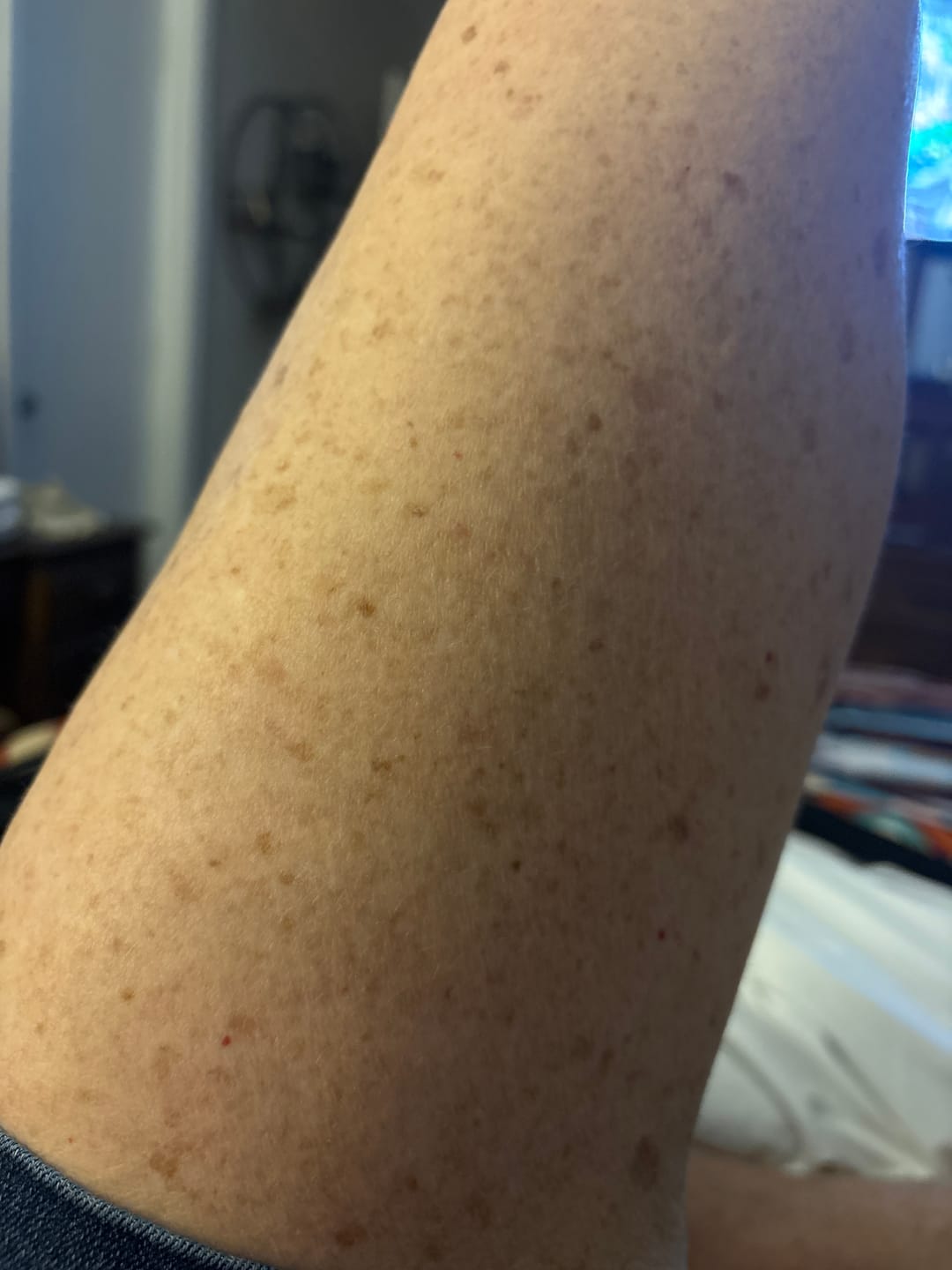Customer photo review of Zentra - Korean Kojic Acid Peel Shot