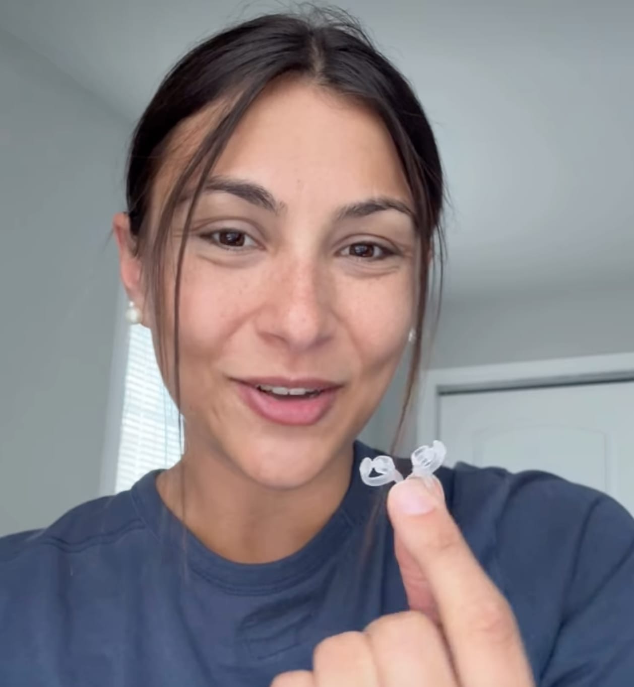 Customer photo review of FLO Nasal Dilator (3 Pack)