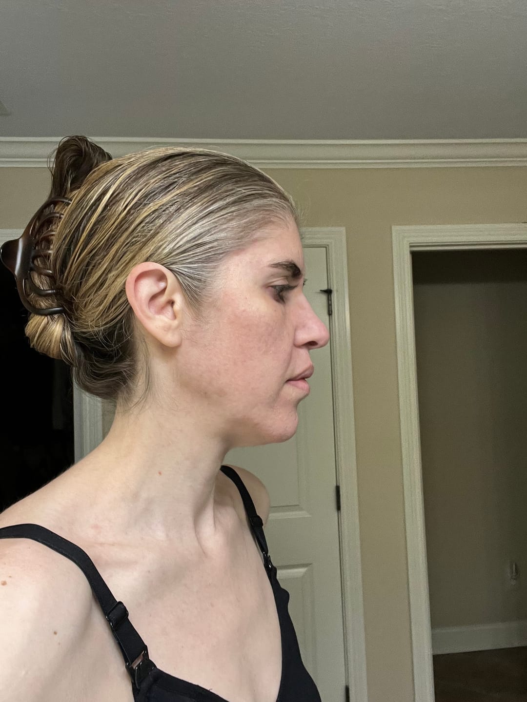 Customer photo review of Super Hydrating Set
