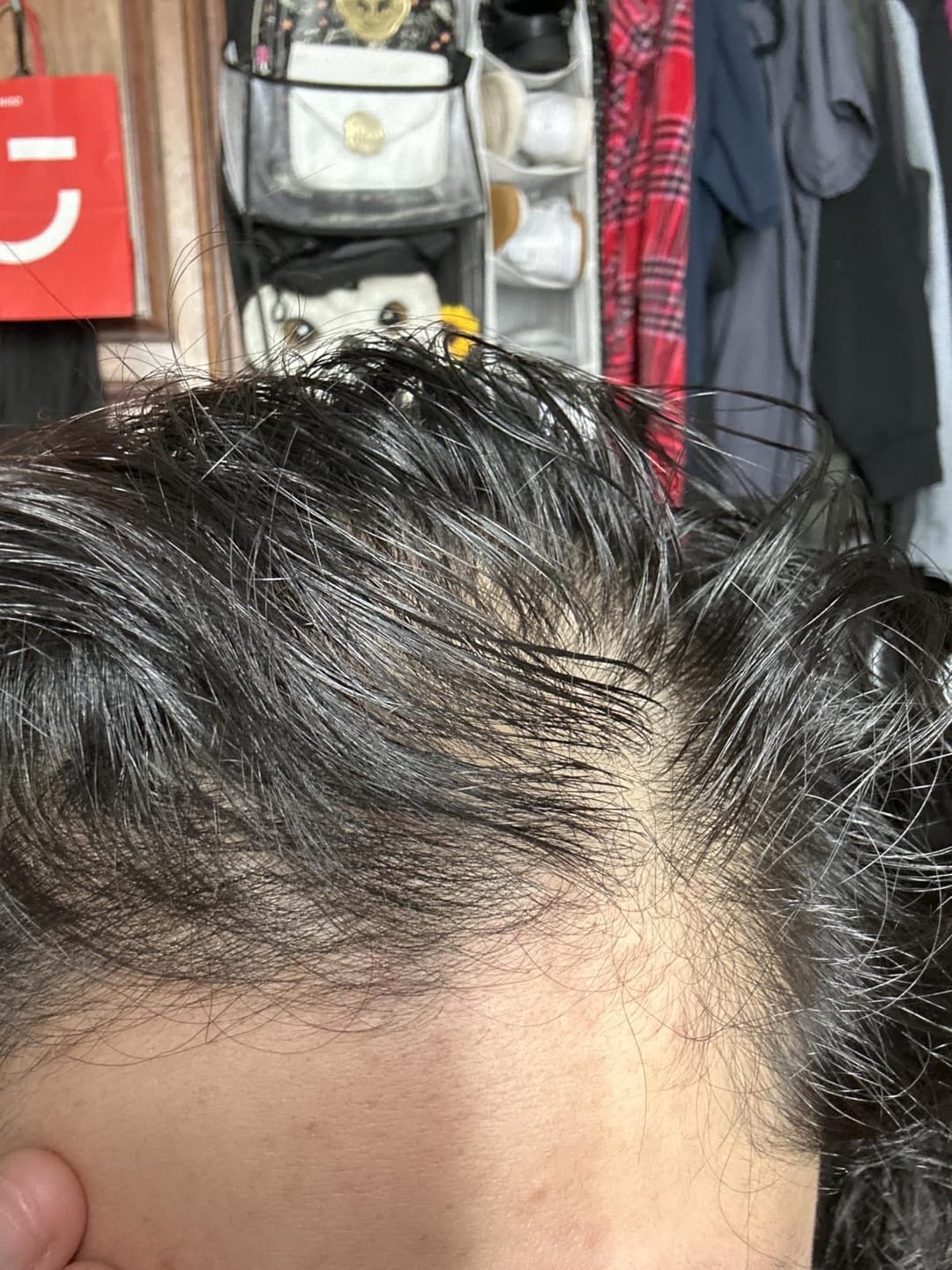 Customer photo review of RootRevive Scalp Serum