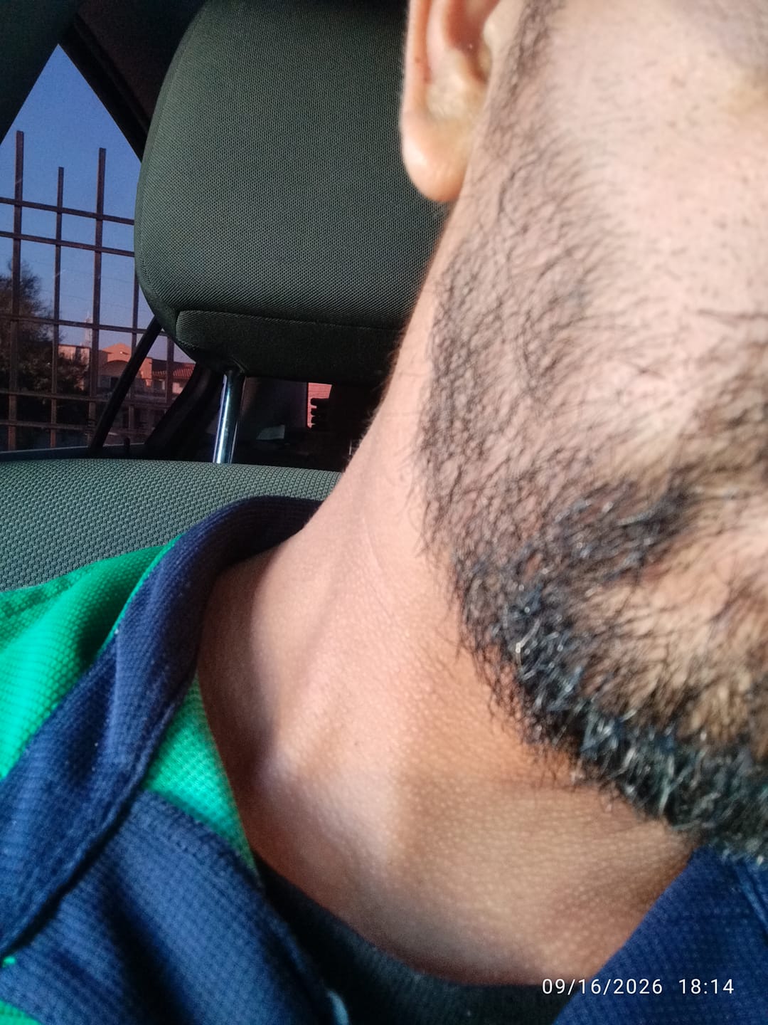 Customer photo review of Kit Barba Real | 2 Minoxidil al 20% +Biotina + Derma | El kit más Completo para crecimiento de Barba