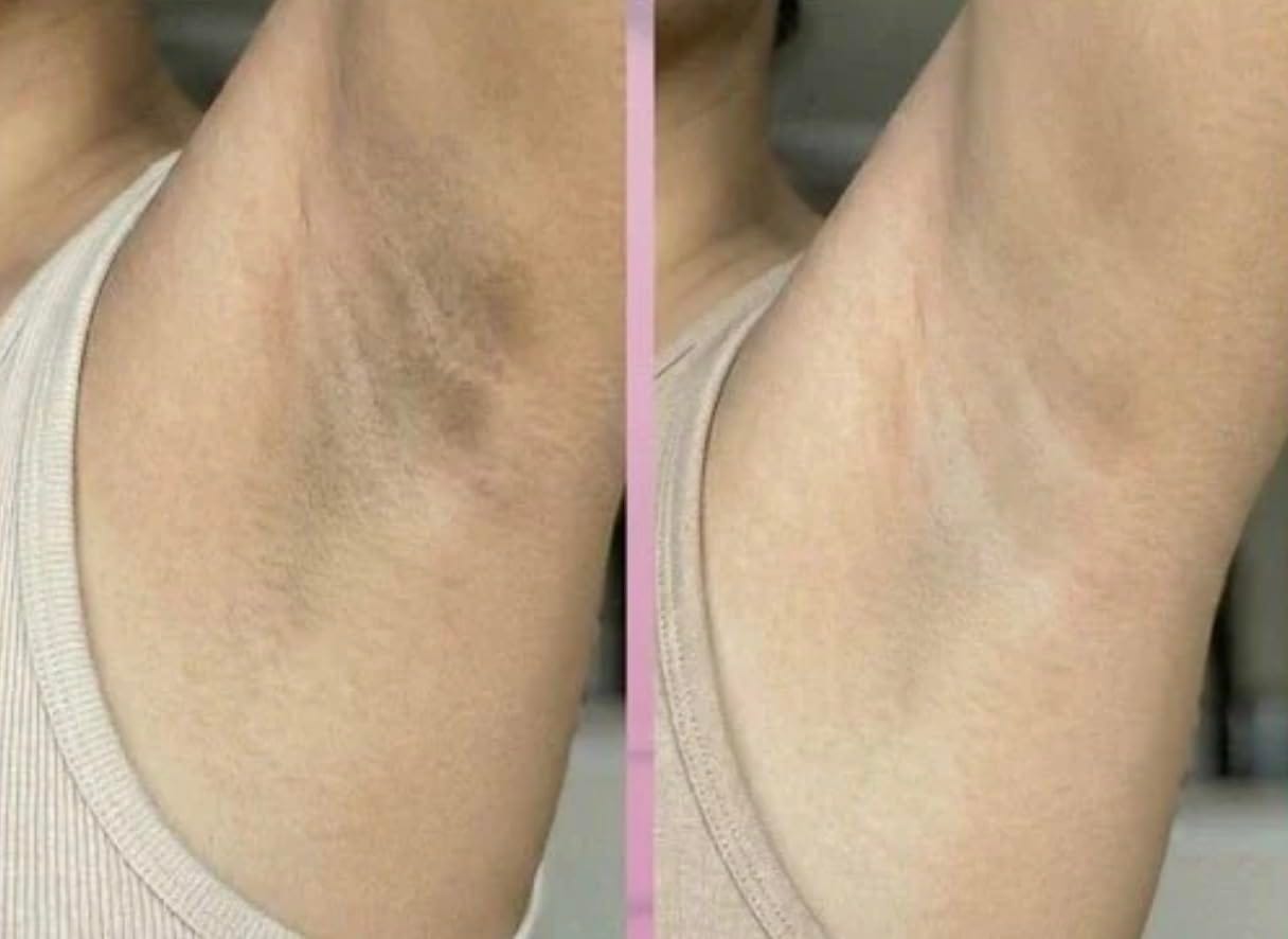 Customer photo review of Spray exfoliante corporal - Kójico + Cúrcuma