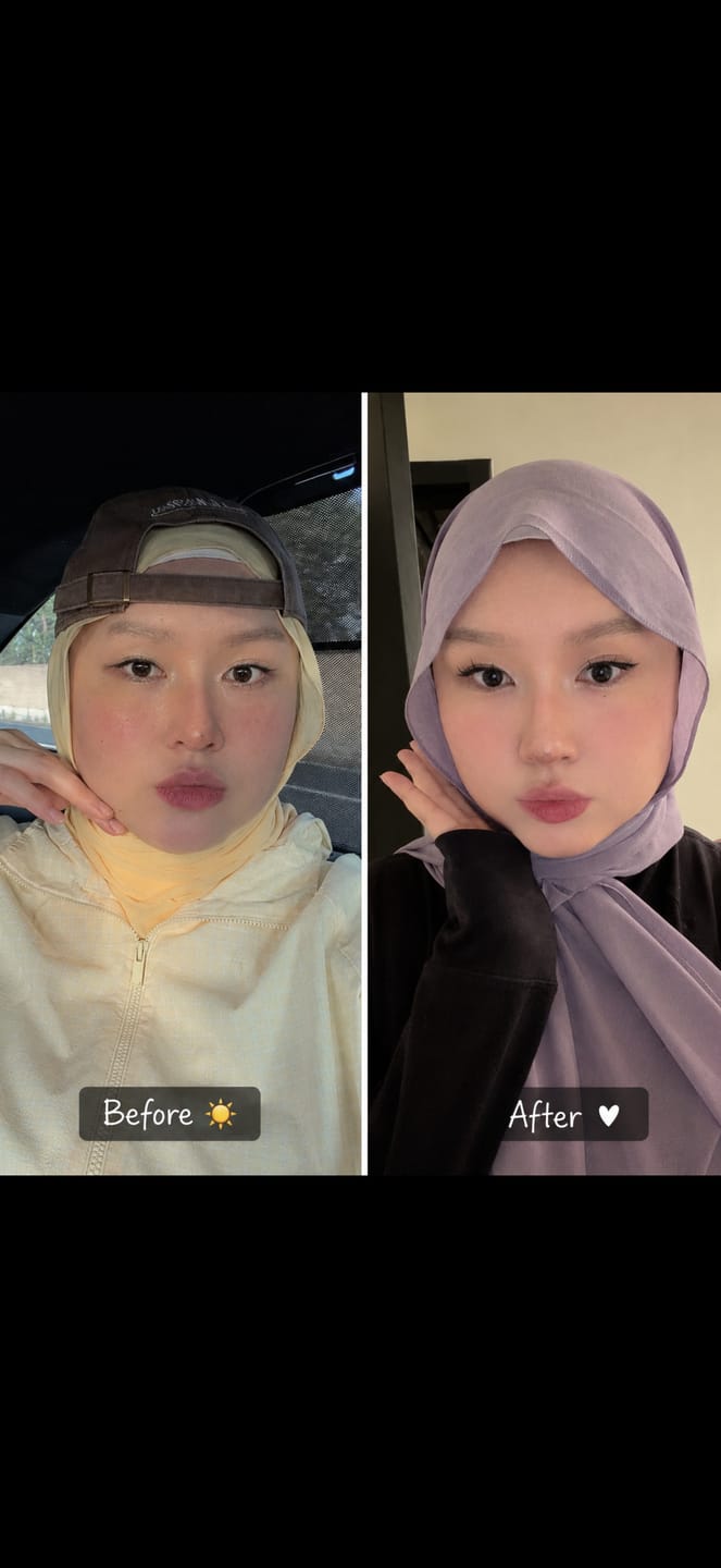 Customer photo review of Madeca Derma Shield Vital Capsule Sun Essence 40ml
