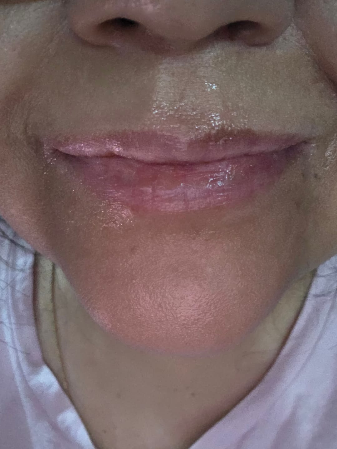 Customer photo review of Blue EGF Barrier Lip Balm