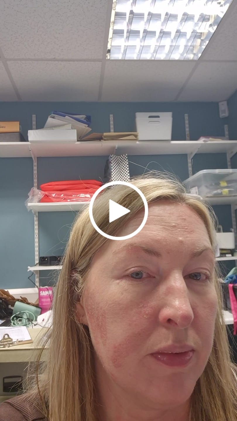 Customer video review of Multi Strain Biotic