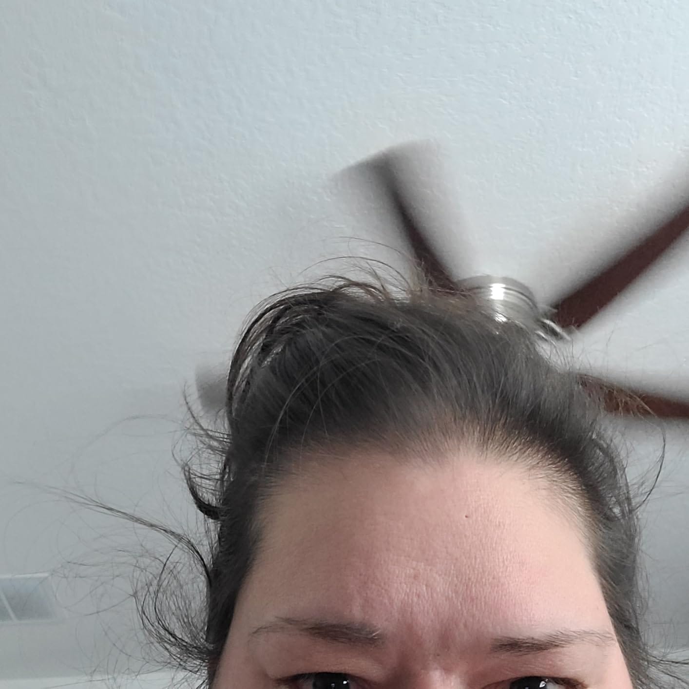 Customer photo review of RootRevive Scalp Serum