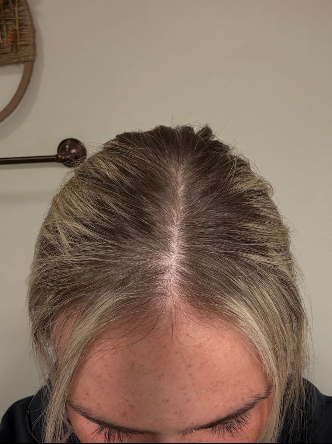 Customer photo review of RootRevive Scalp Serum