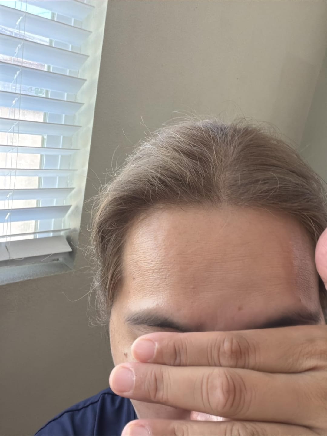 Customer photo review of RootRevive Scalp Serum