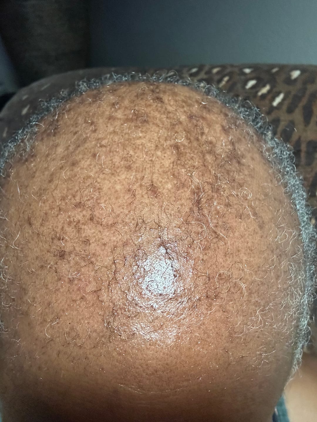 Customer photo review of Scalp Balancing Shampoo