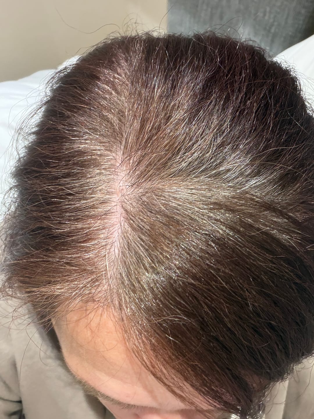Customer photo review of Instant Dye Shampoo