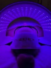 Customer photo review of L6 Red & Near-Infrared LED Light Therapy Panel
