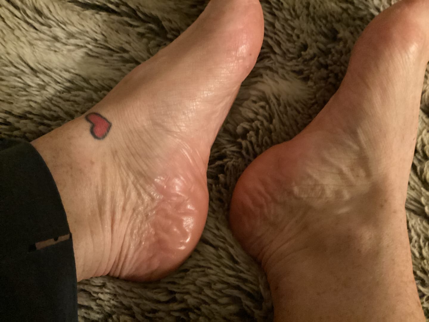 Customer photo review of Dovena NanoCure