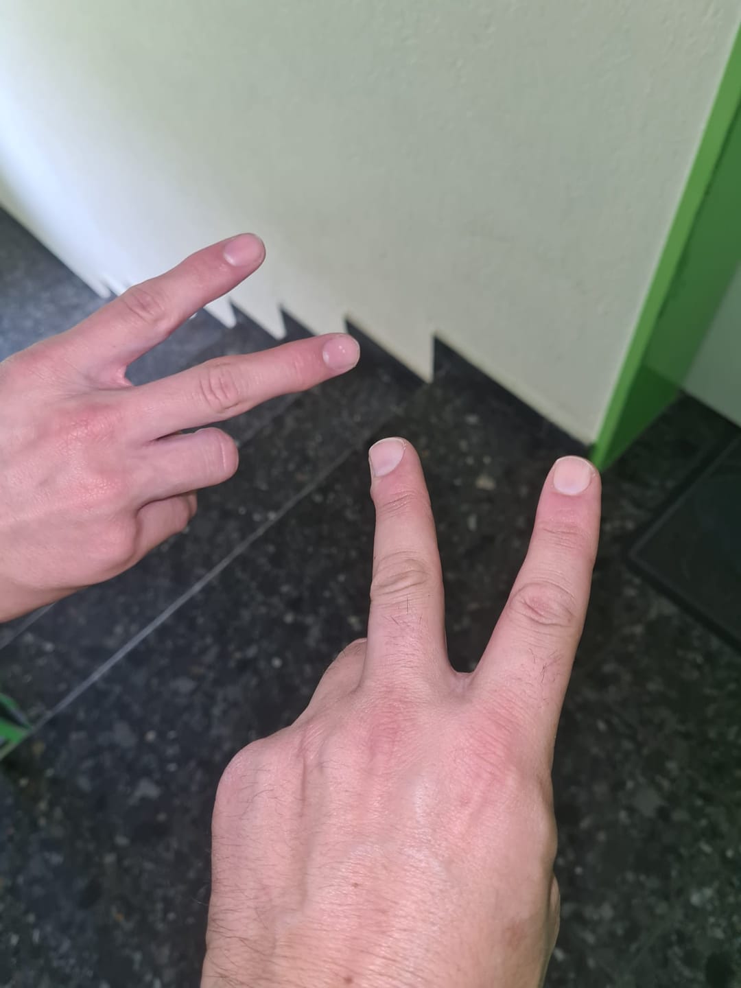 Customer photo review of Blueberry CBD 25%