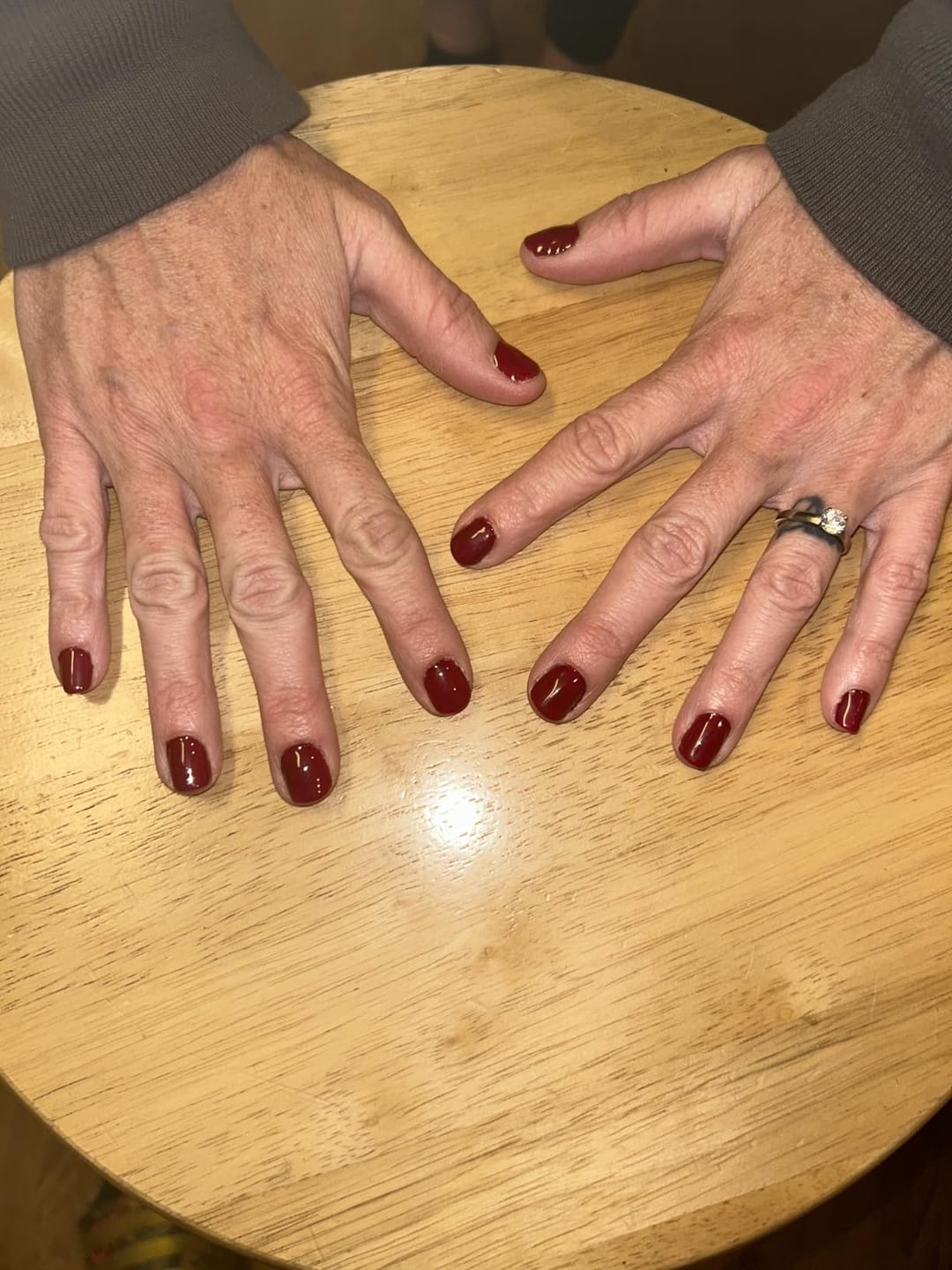 Customer photo review of GlowMod™ All in One Nail Pen