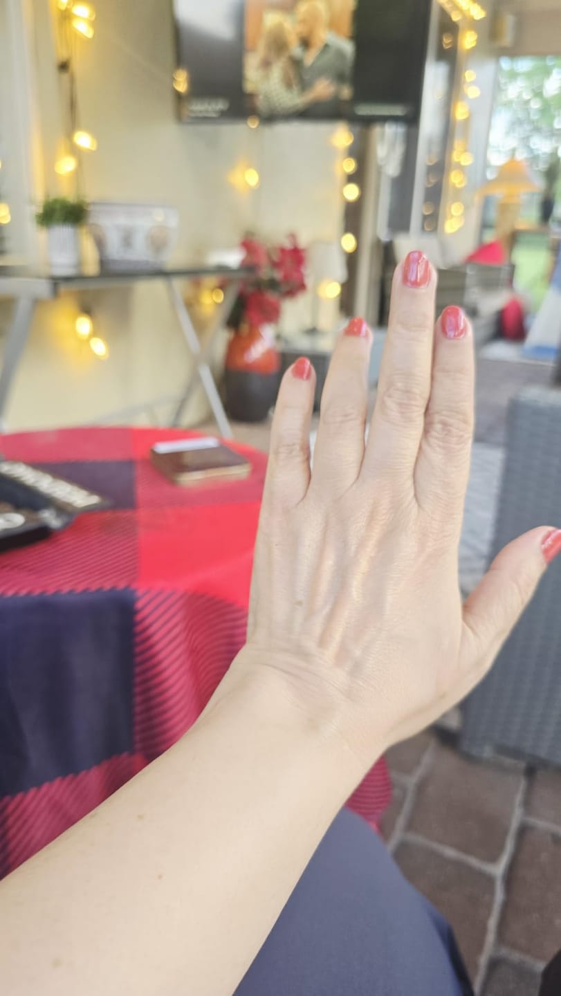 Customer photo review of GlowMod™ All in One Nail Pen