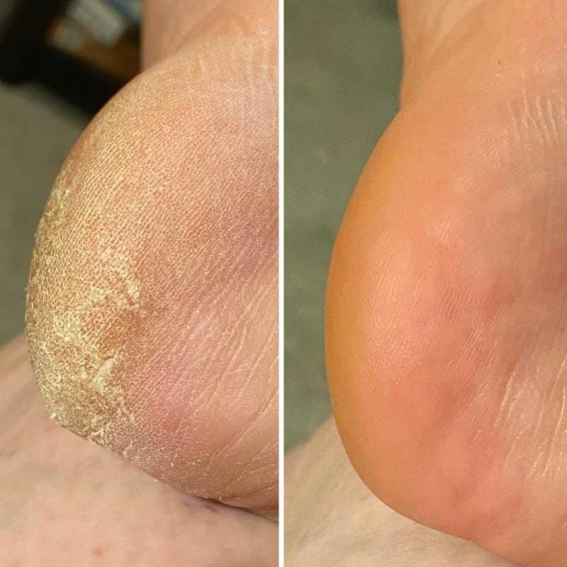 Customer photo review of Pulidor Eléctrico de Talones