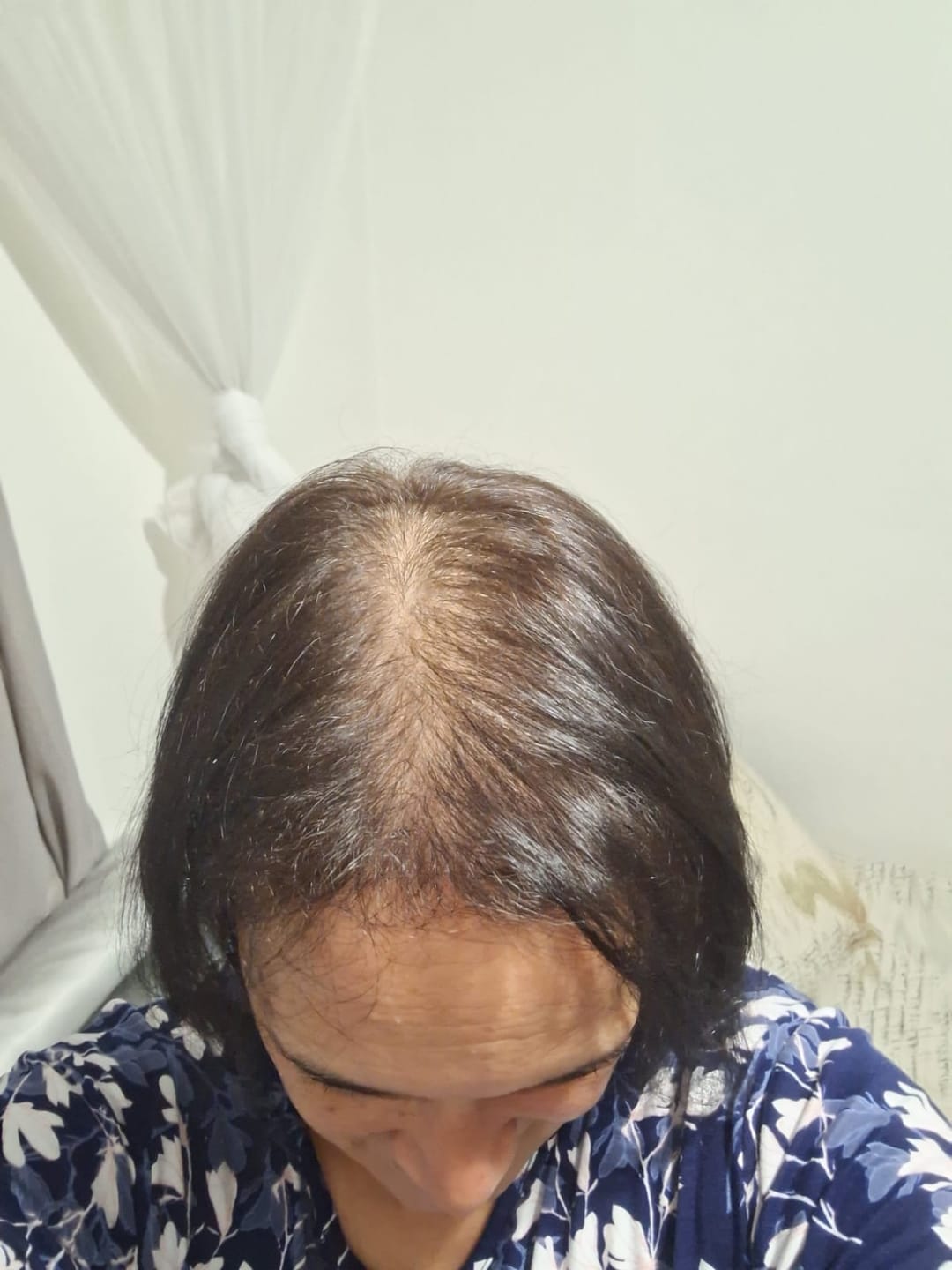 Customer photo review of Hair & Nail Herbs Tincture