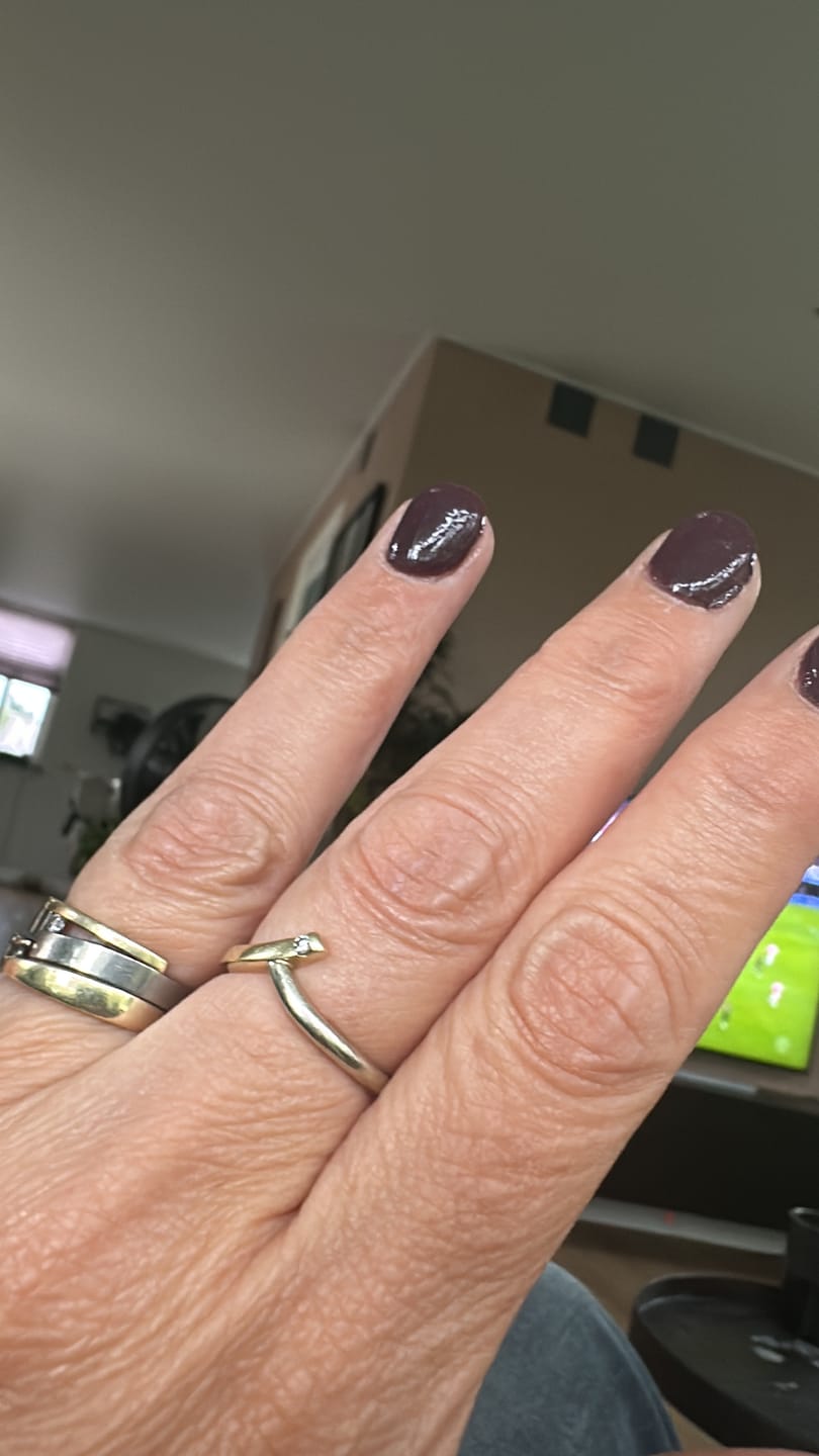 Customer photo review of Verzending Verzekering