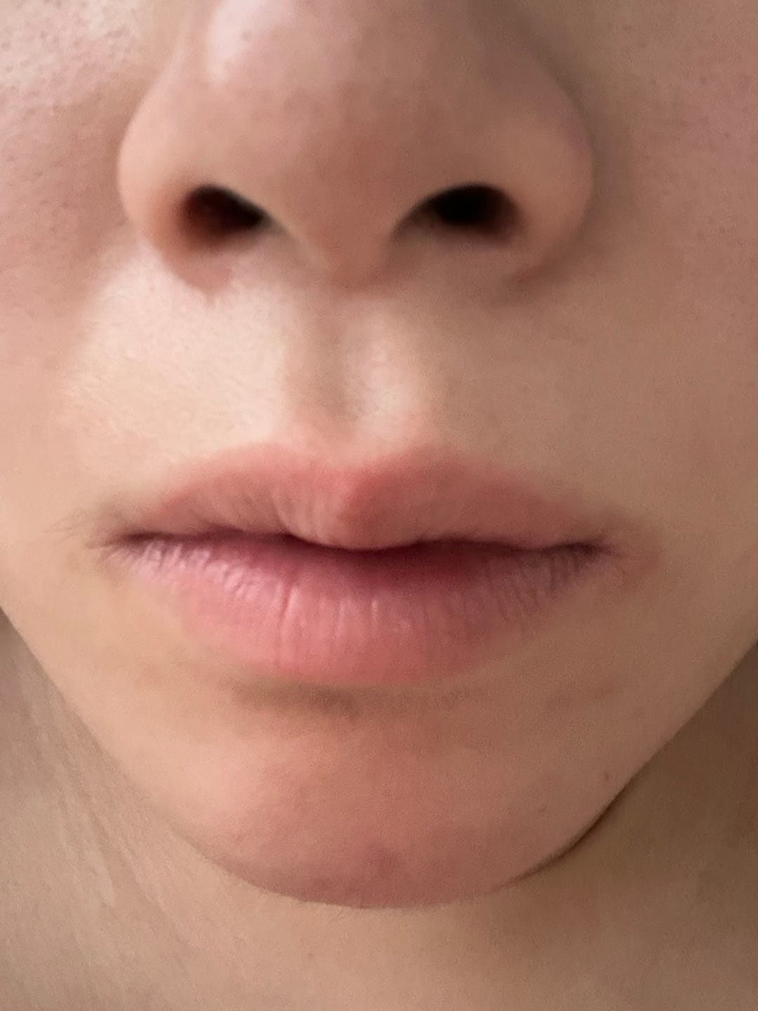 Customer photo review of Blue EGF Barrier Lip Balm