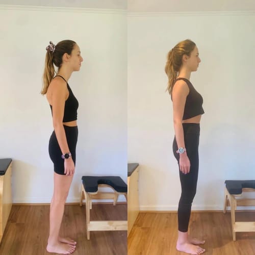 Customer photo review of Ayarlanabilir Dik Duruş Korsesi