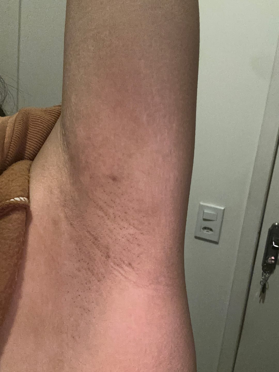 Customer photo review of Creme Clareador de Manchas – Melasma, Axilas, Virilha, Áreas Íntimas, Rosto e Corpo