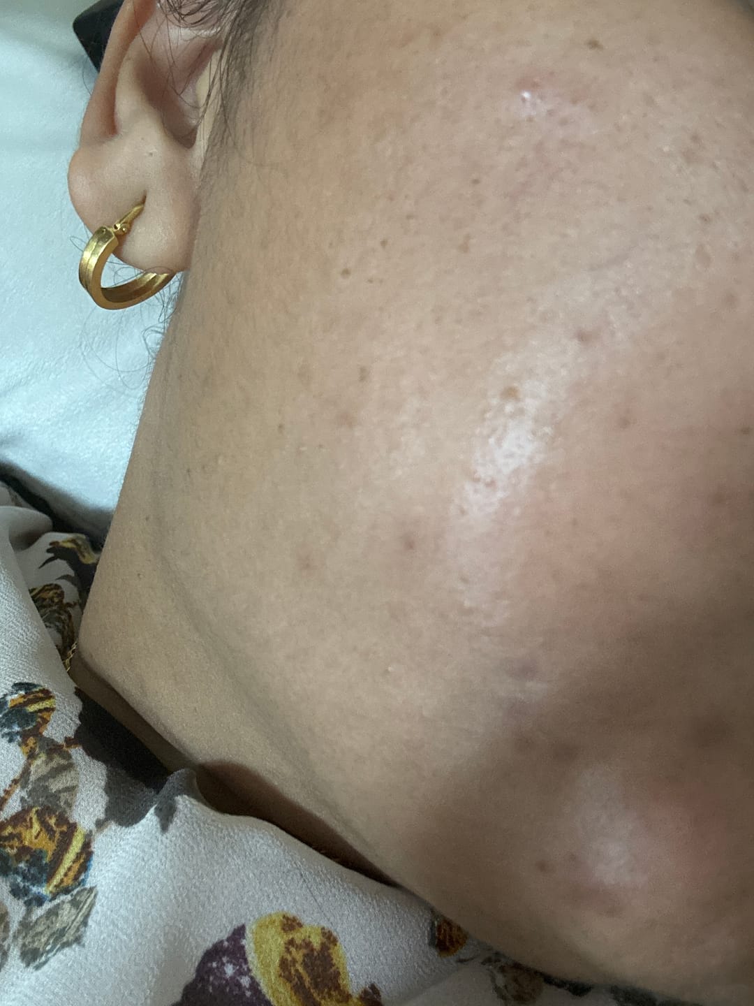 Customer photo review of Turmeric Night Repair Cream