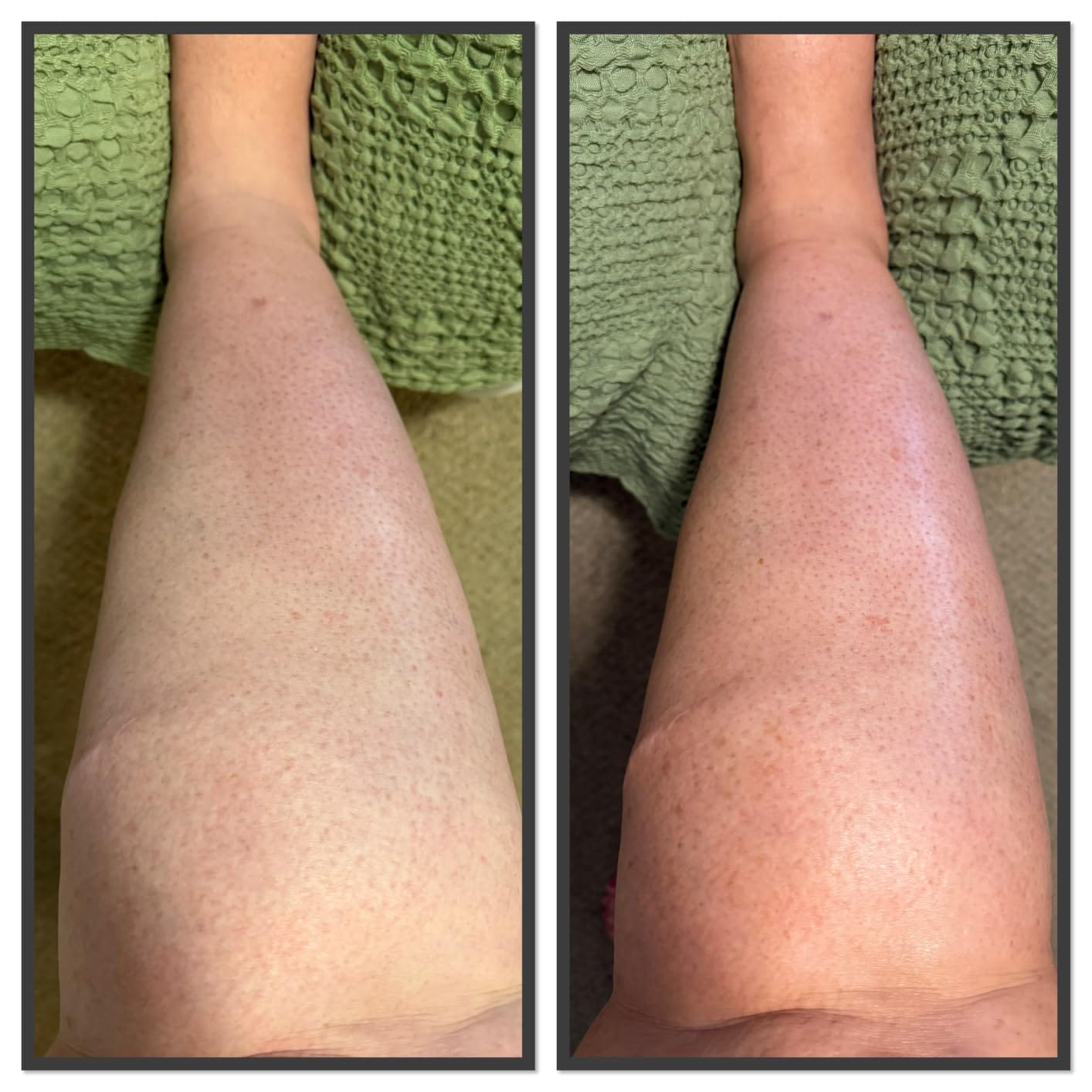 Customer photo review of The Quickie