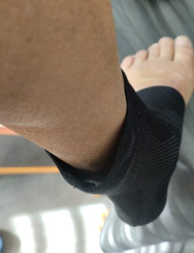 Customer photo review of Nurvo Support™ | Tobillera de compresión